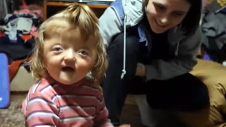 Disabled Girl Banned From Nursery Because 'Her Deformed Skull Will Scare Other Kids'