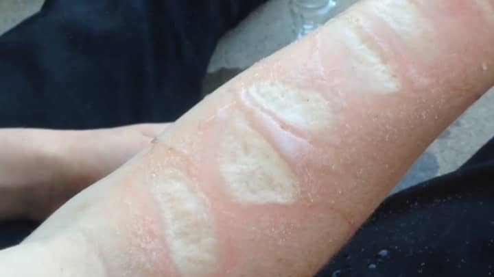 The 'Salt And Ice Challenge' Is The Dumbest Challenge Yet By Far