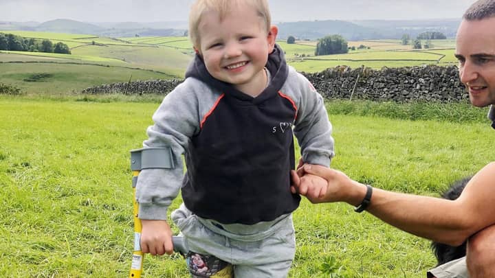 Four-Year-Old Boy Walks For First Time On Prosthetic Legs After Contracting Sepsis