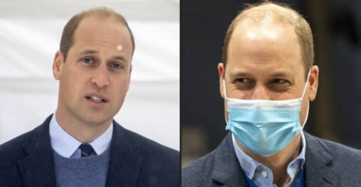 Prince William Named As World's Sexiest Bald Man