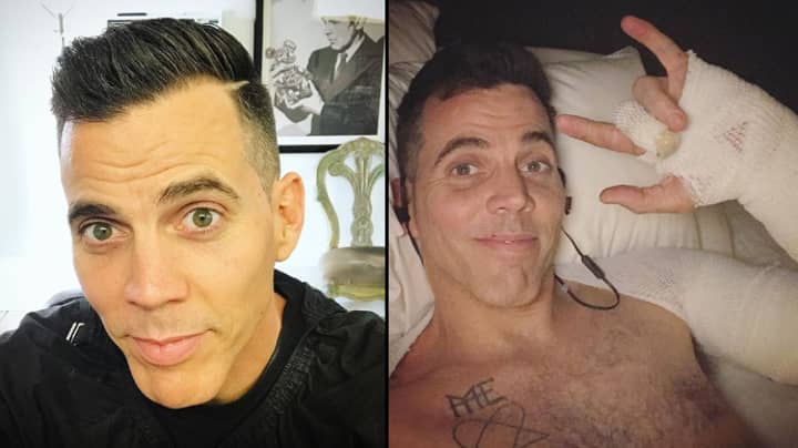 Steve-O's Ear Left In Tatters From A Stunt Gone Wrong