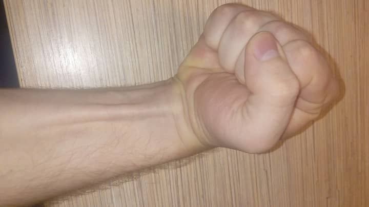 Around 15 Percent Of People Don't Have This Muscle In Their Arm