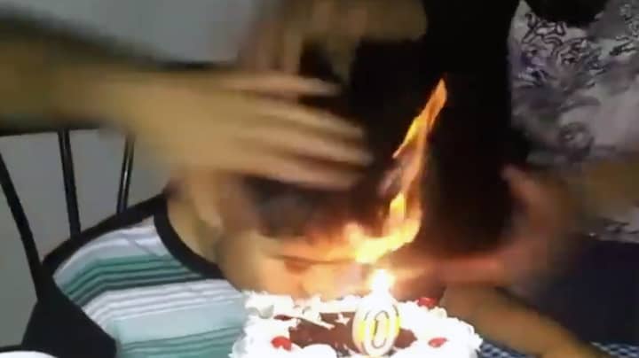 Worst Birthday Ever: Watch As This Kid Sets Fire To His Own Hair At Birthday Party