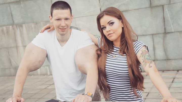 'Popeye' Bodybuilder Who Injects Oil Into Biceps Is Getting Married 