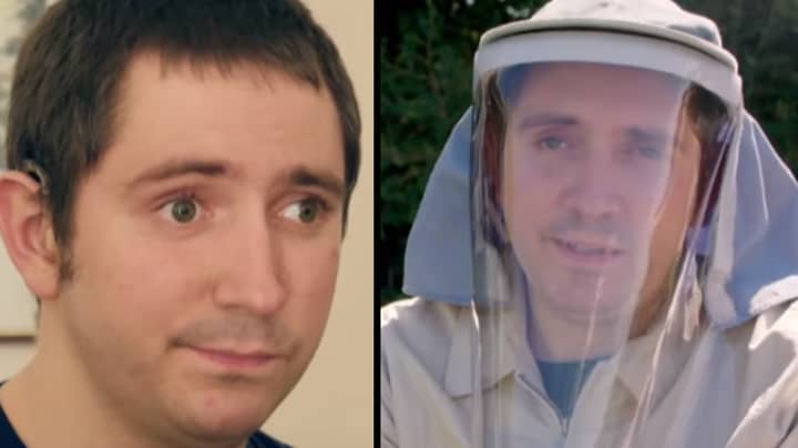Replica Skin Mask Helps Man Who Is Allergic To The Sun