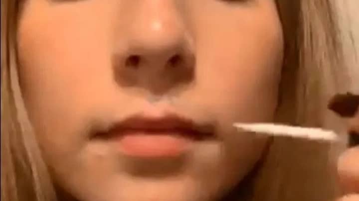Health Experts Warn Against New Beauty Trend Of Glueing Top Lip To Skin Beneath Nose