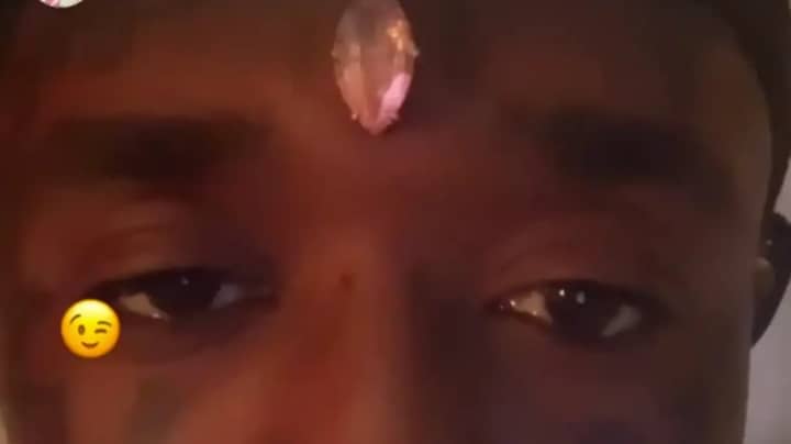 Lil Uzi Vert Says Forehead Diamond Got Ripped Out by Fans