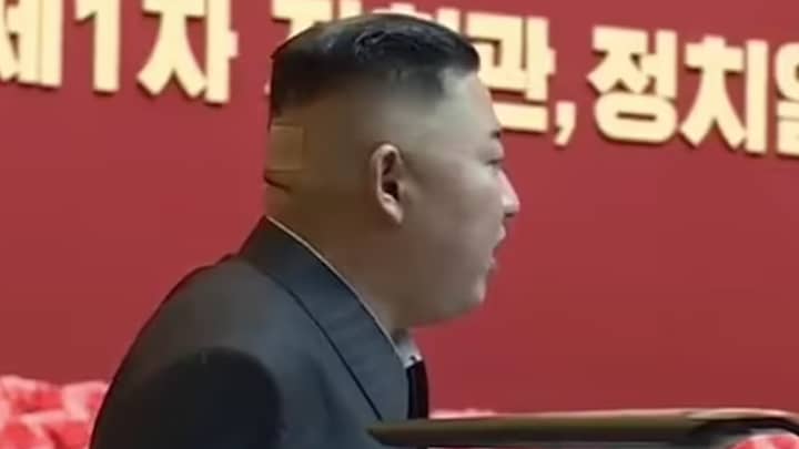 Kim Jong-Un Spotted With Plaster And Dark Mark On His Head
