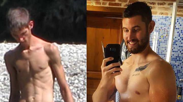 Anorexic Bodybuilder Beats His Demons After Finding Love