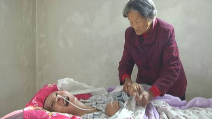 Chinese Man Wakes From 12-Year Coma After Elderly Mum Nursed Him