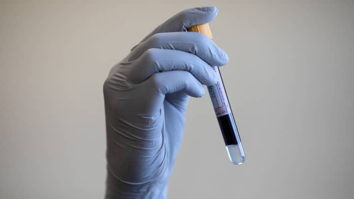 NHS Trials 'Revolutionary' Blood Test That Could Detect 50 Types Of Cancer