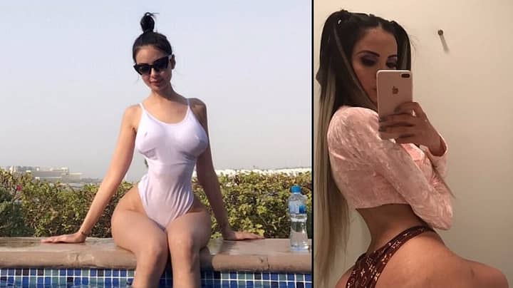 Woman Has Four Pints Of Fat Injected Into Her Arse To Look Like Kim Kardashian 