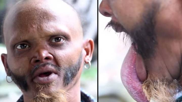 Man Shows Off Bizarre Ability To Lick His Own Forehead 